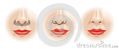 Scheme correction of the upper lip. Vector Illustration