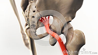 Sciatic Pinched Nerve Illustration Stock Photo