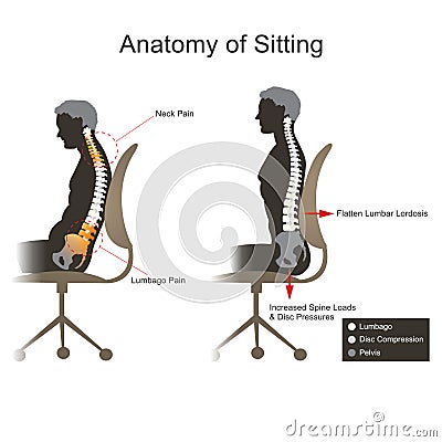 Sciatica. Health care info graphic . Stock Photo