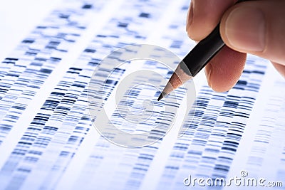 Scientist analyzes DNA gel Stock Photo