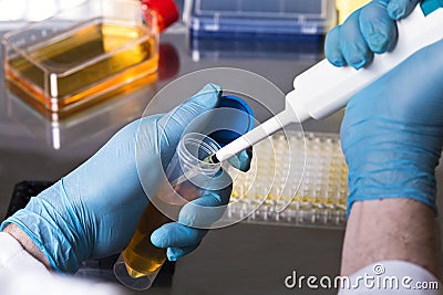 scientist pipetting a sample from a test tube for a clinical test Stock Photo