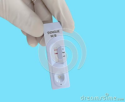 Scientists or Lab Technologists hold a device of Dengue IgG, IgM rapid screening test. Stock Photo
