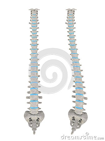 Scoliosis Cartoon Illustration