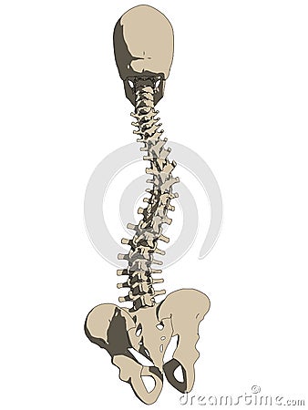 Scoliosis Vector Illustration