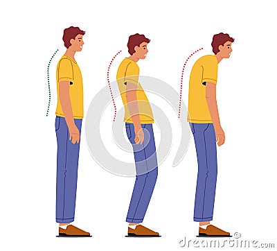 Scoliosis and Spine Backbone Curvature Concept. Man with Correct and Wrong Posture Bad and Good Body Pose Vector Illustration