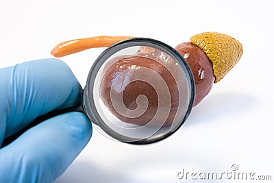 Search disease, abnormalities or pathology of kidney concept photo. Doctor holding magnifying glass and examines model of kidney, Stock Photo