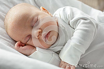 Seborrheic dermatitis on baby`s face. Stock Photo