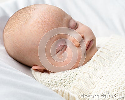 Seborrheic dermatitis on the head of newborn baby. seborrhea atopic dermatitis on child`s face forehead Stock Photo