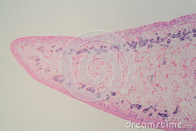 Section of a common liver fluke Fasciola under the microscope Stock Photo