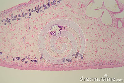 Section of a common liver fluke Fasciola under the microscope Stock Photo