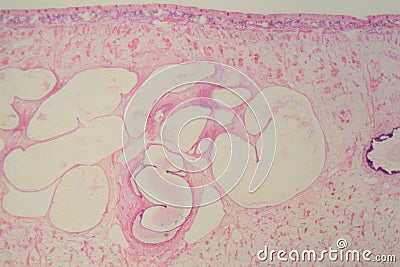 Section of a common liver fluke Fasciola under the microscope Stock Photo