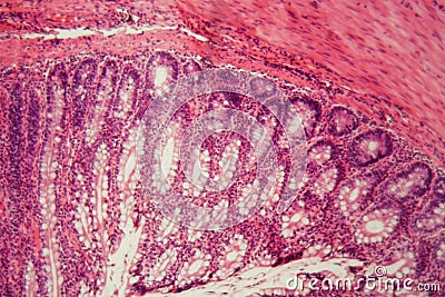 Section of a dog ciliated epithelium Stock Photo
