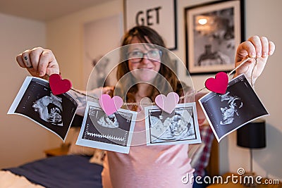 Pregnant woman holds echography scans Stock Photo