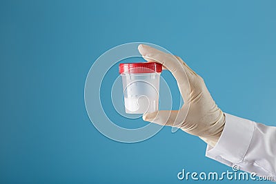 Semen in a jar for analysis in the doctor`s hand on a blue background Stock Photo