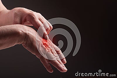 Senior hands. Suffering from pain and rheumatism Stock Photo