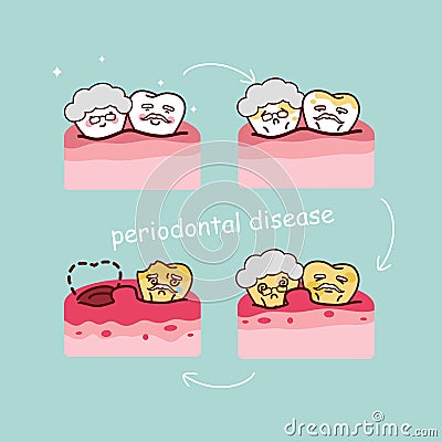 Senior tooth with periodontal disease Vector Illustration