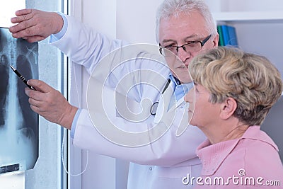 Senior woman with lung cancer Stock Photo