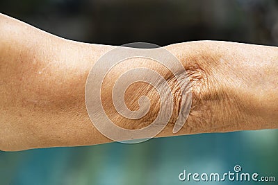 Senior woman raising her arm and elbow on swimming pool background, Asian Body skin part, Healthcare and beauty concept Stock Photo