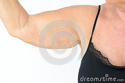 Senior woman showing flabby arm, effect of aging Stock Photo