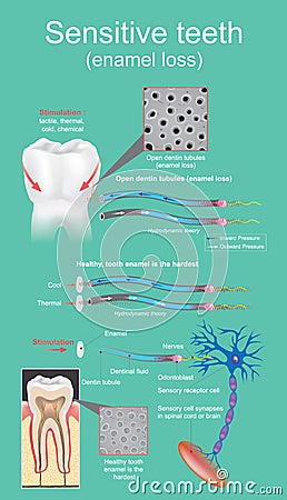 Sensitive dental. Stock Photo