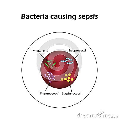 Sepsis. Blood poisoning. E. coli. Streptococci. Pneumococci. Staphylococci. Vector Illustration