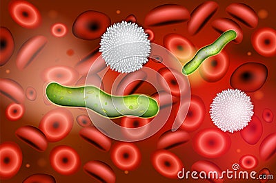 Sepsis is an inflammatory immune response triggered by an infection. Vector Illustration