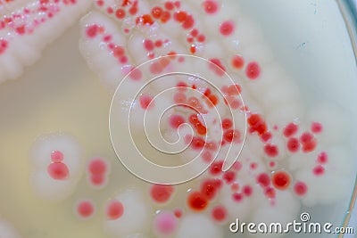 Serratia marcescens is a species of rod-shaped gram-negative bacteria. Stock Photo