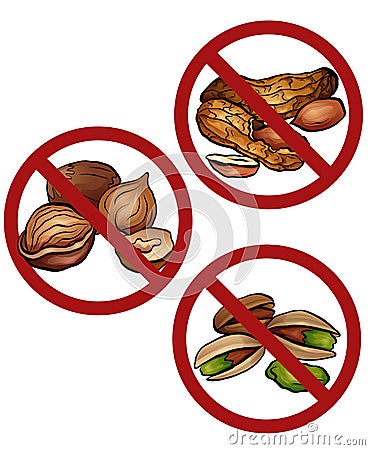 Set of cartoon nuts in the prohibition sign. Free from nuts. Ban on allergens. Allergy Alert. Badges with forbiddance Vector Illustration