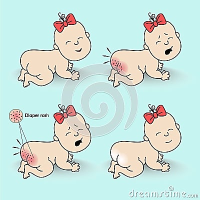 Set diaper rash Vector Illustration