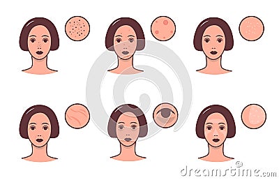 Set of female faces with various skin conditions and problem. Skincare and dermatology concept. Vector colorful Vector Illustration