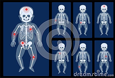 Skeleton x ray Vector Illustration