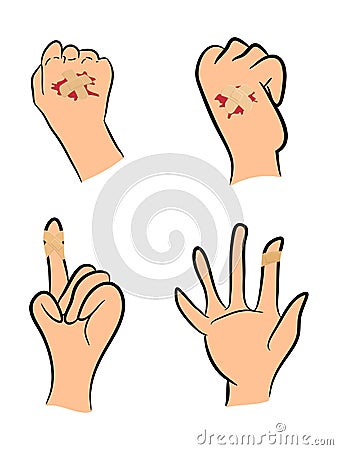 Set of Injured finger and hand with adhesive plaster and red blood puddle. Vector illustration on white background. Vector Illustration