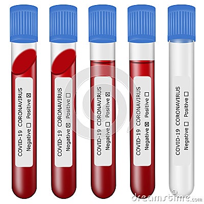 Set of isolated coronavirus blood tests. full and empty test tubes with labels. positive and negative tests Vector Illustration