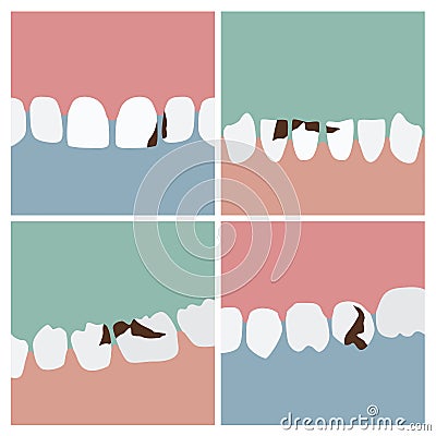 Teeth with cavities illustrations Vector Illustration