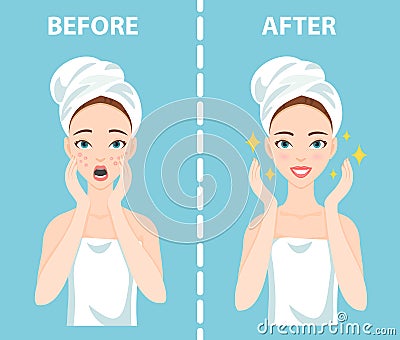 Before-After set of upset and happy woman with female facial skin problems needs to care about: acne, pimples. Vector Illustration