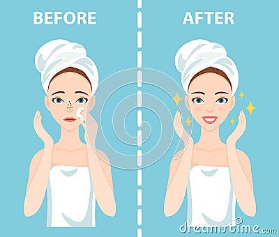 Before-After set of upset and happy woman with female facial skin problems needs to care about: blackheads, clogged nose Vector Illustration