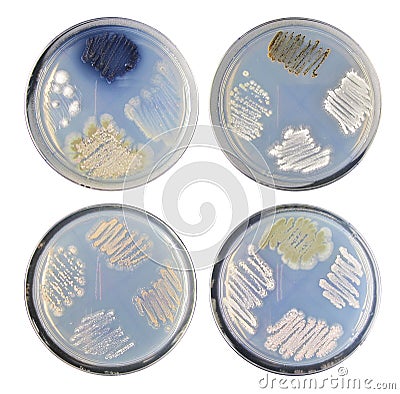 Set of varity colony bacteria (actinomycetes) morphology on agar Stock Photo