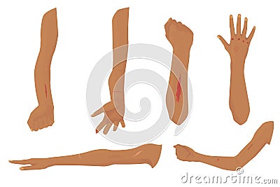 Set of wounds and abrasions on hands isolated on white background. ripped knuckles, cuts, stitches on the wound, scars, scratches Vector Illustration