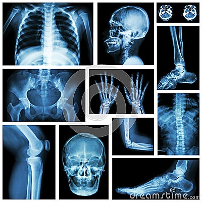 Set of x-ray multiple part of human . Skeletal system . Stock Photo