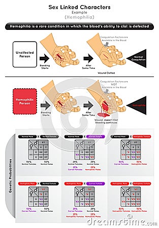 Sex Linked Characters Infographic Diagram example hemophilia bleeding Vector Illustration