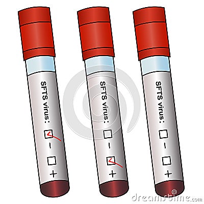 SFTS virus and test tubes with patient analyzes. Vector set of illustrations. Isolated white background. Three results. Collection Vector Illustration