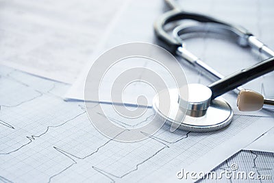 Sheets of paper with cardiogram, stethoscope, lay on a table Stock Photo