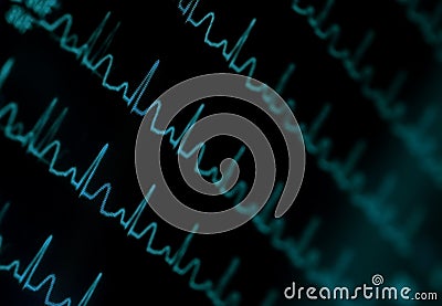 Shimmering ECG monitor Stock Photo