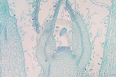 Shoot meristem is the tissue in most plants containing undifferentiated cells Stock Photo