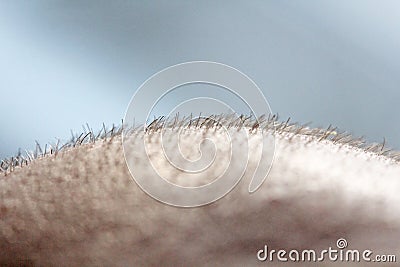 Short hair on a head close up. Scalp Man`s head. Baldness. Bald man. Problems with hair growth on the head Stock Photo