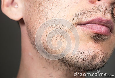Short, sparse beard on mans face. Hair growth problems. Man with alopecia area in the beard. Unshaven bristles on the beard Stock Photo