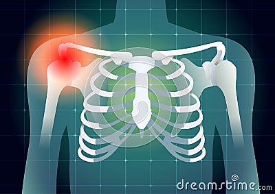 Shoulder bone have a red signal Vector Illustration