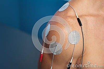 Shoulder Electrical Stimulation / TENS Stock Photo