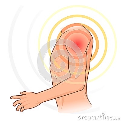 Shoulder pain Vector Illustration