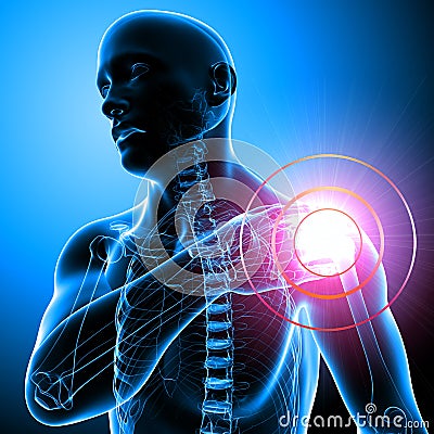 Shoulder pain of male in blue Cartoon Illustration